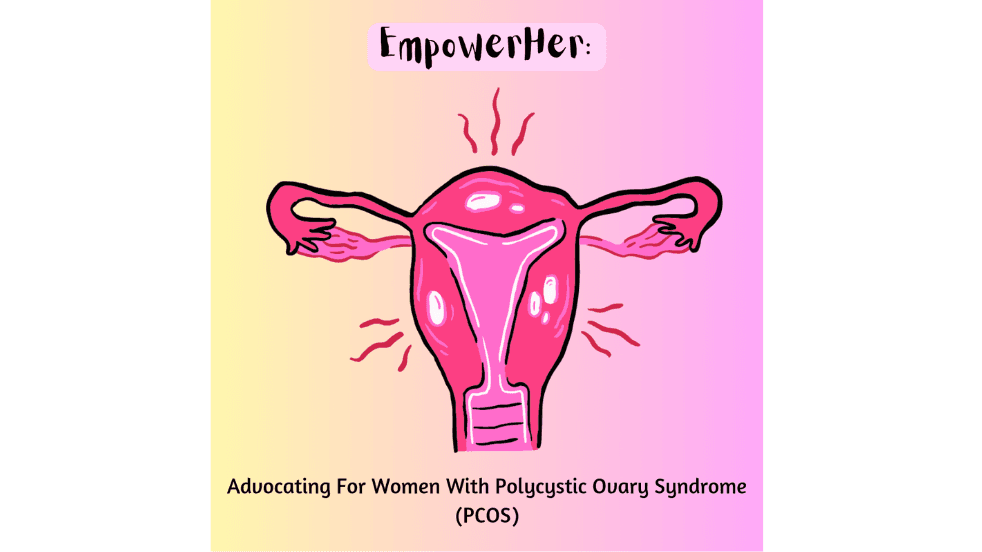 PCOS 